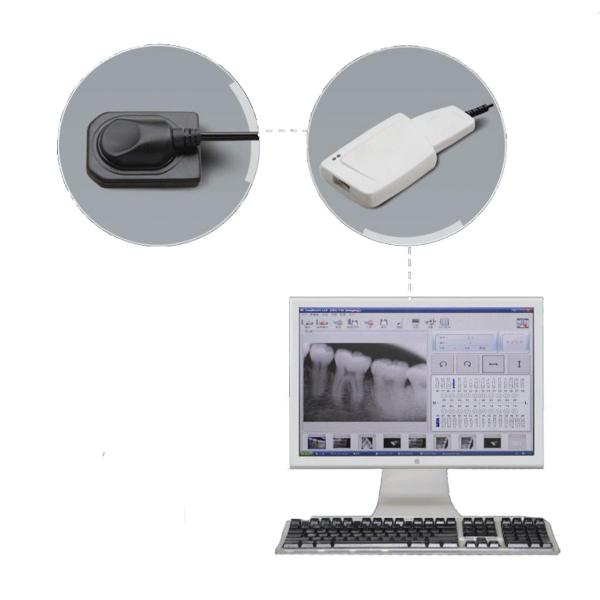 Sistema de imágenes digitales de rayos X intraoral